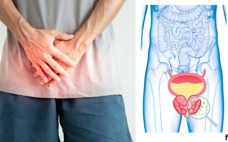 TotalControl24-prostate 